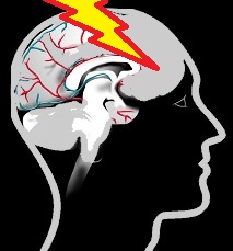 Head trauma and headaches