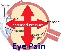 Eyepain and Glaucoma