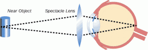 Eyestrain and corrective lenses